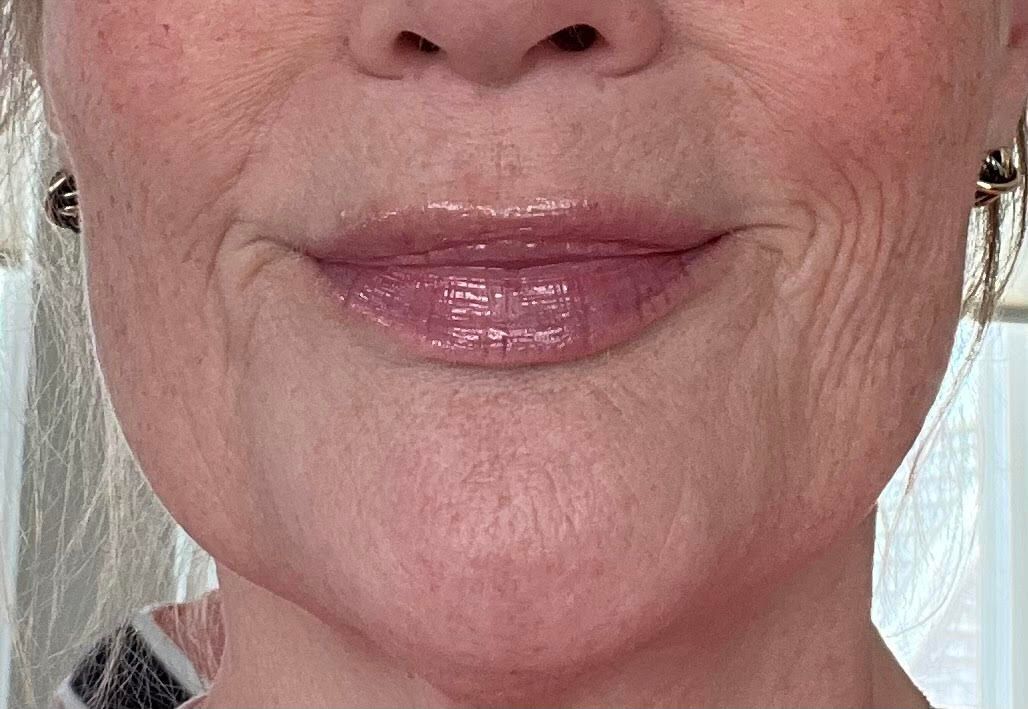 Close-up of a person's mouth and lower face, smiling, with visible wrinkles and shiny lip gloss.