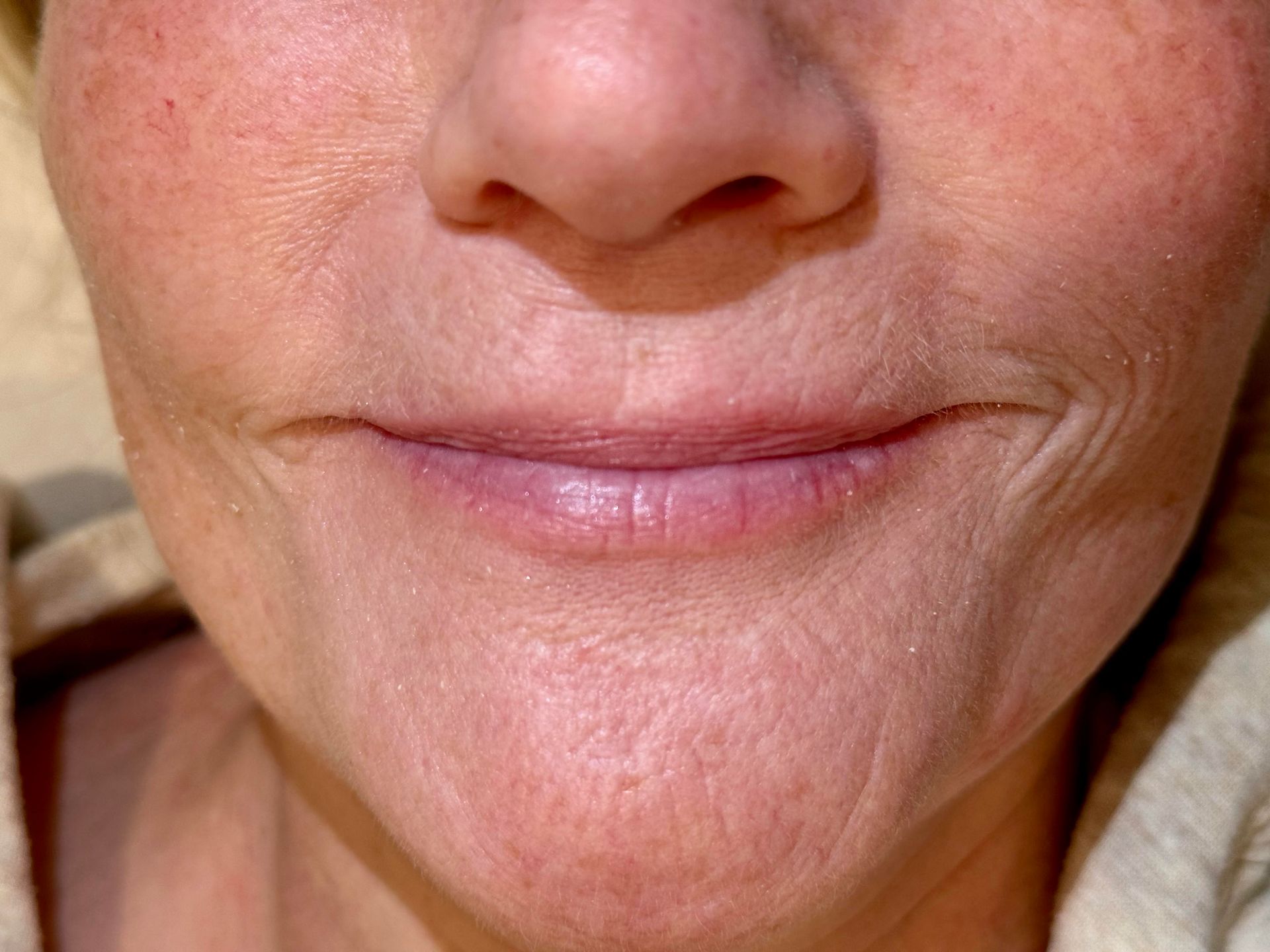 Close-up of a person's mouth and nose. Pink lips, visible wrinkles, and subtle skin texture.