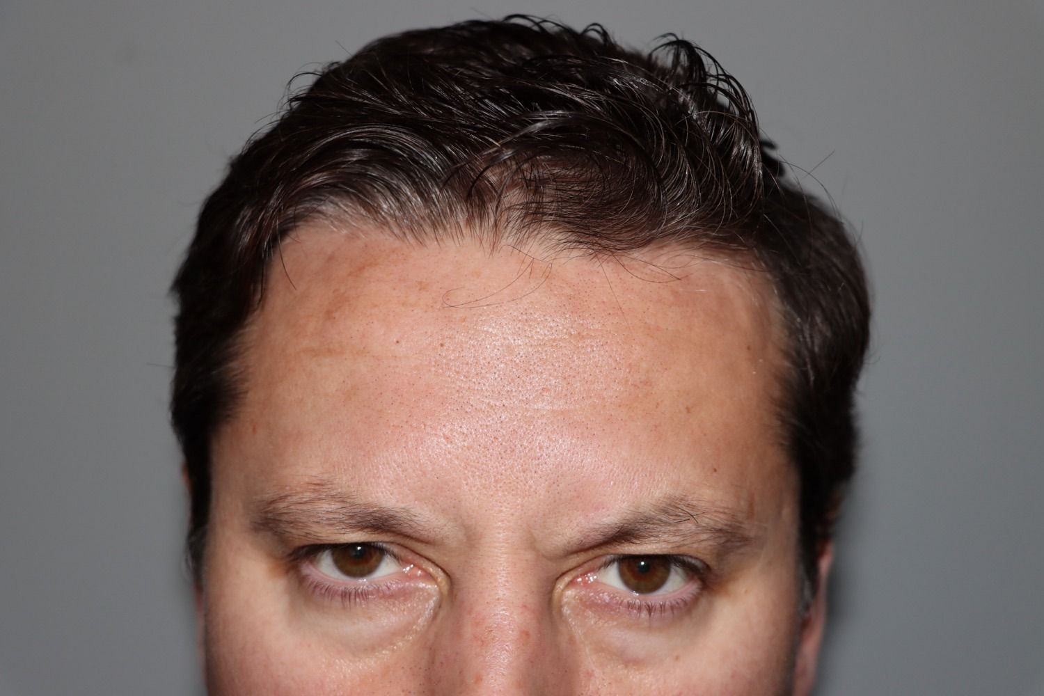 Close-up of a man's face, dark hair, brown eyes, looking forward.