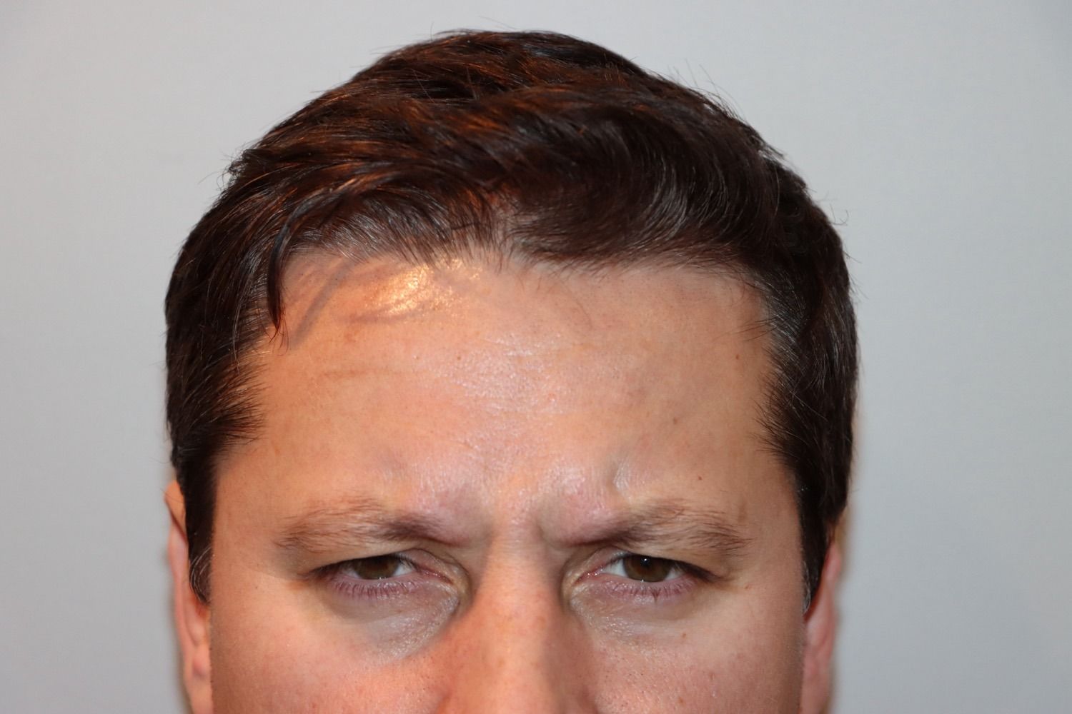 Man with dark hair and furrowed brow, looking downwards.