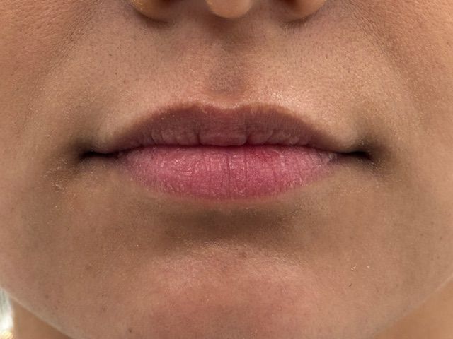 Close-up of a person's lips; lips are natural pink, small, and closed.