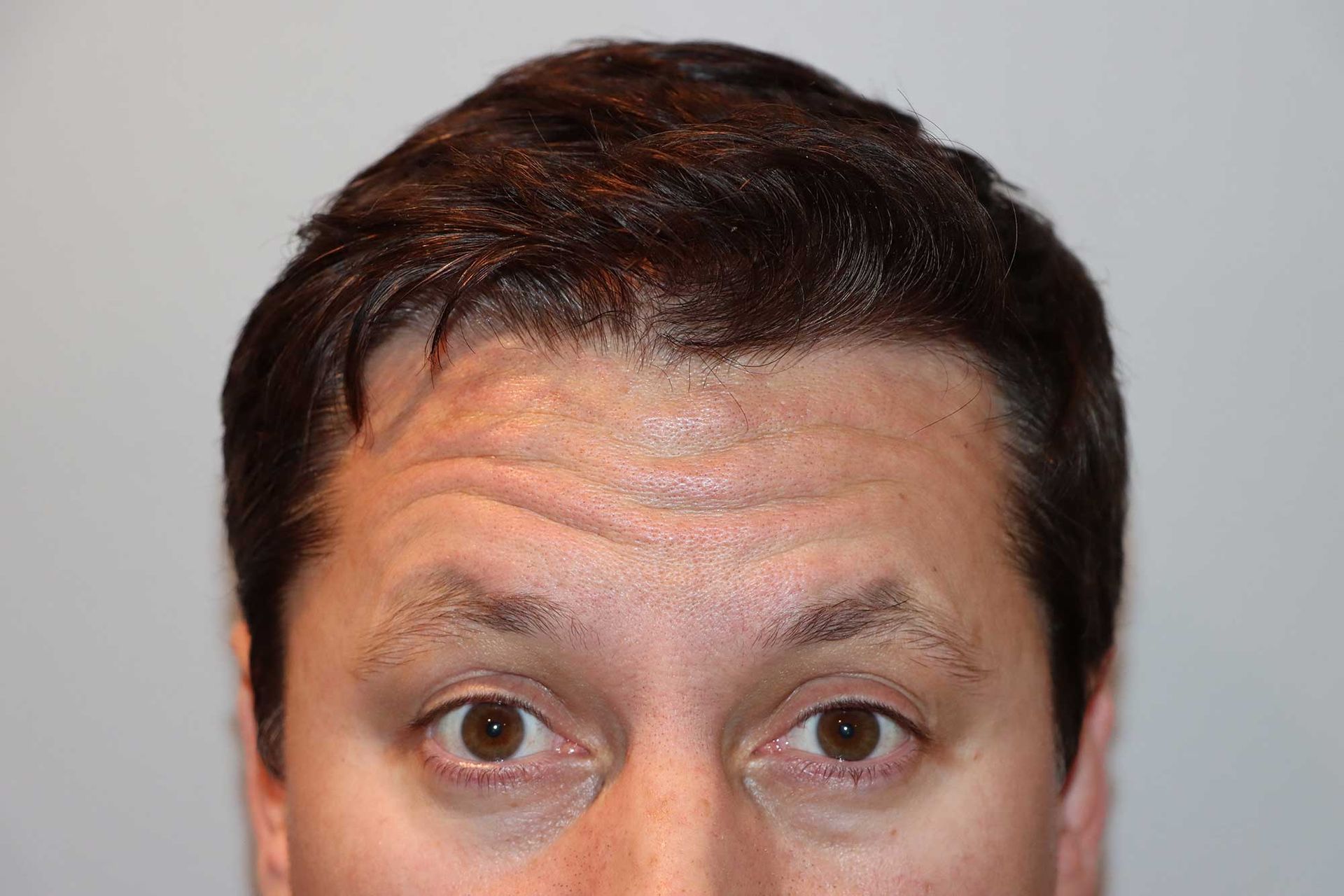 Man with dark hair and brown eyes; looking at the viewer. Slightly wrinkled forehead.