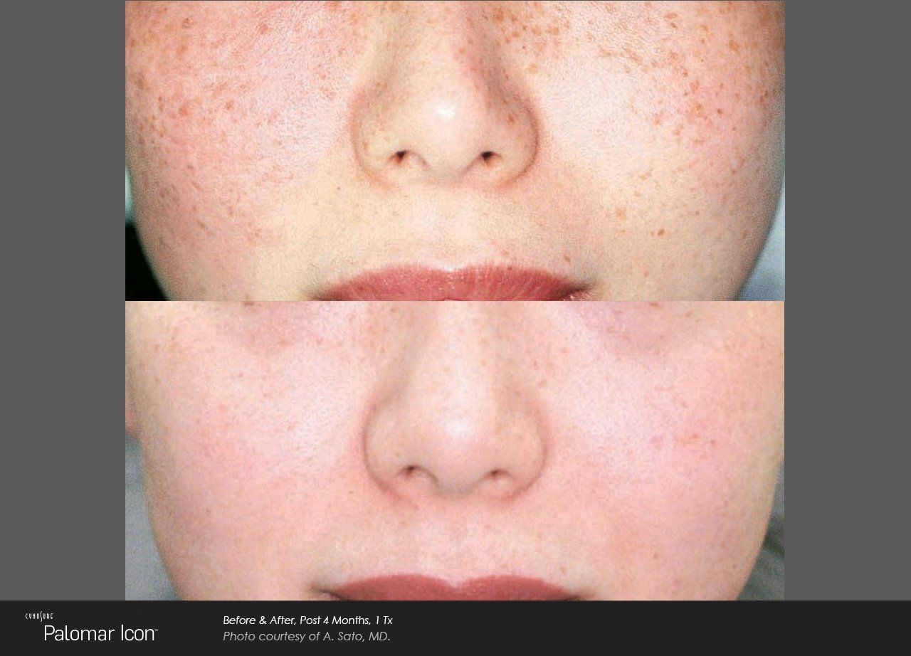 Skin revitalization