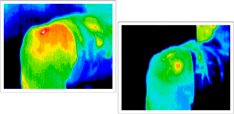 Two thermal images showing localized heat patterns on a human shoulder, ranging from cool blue to warm red and yellow.