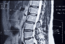 dr-gary-b-lower-back-pain