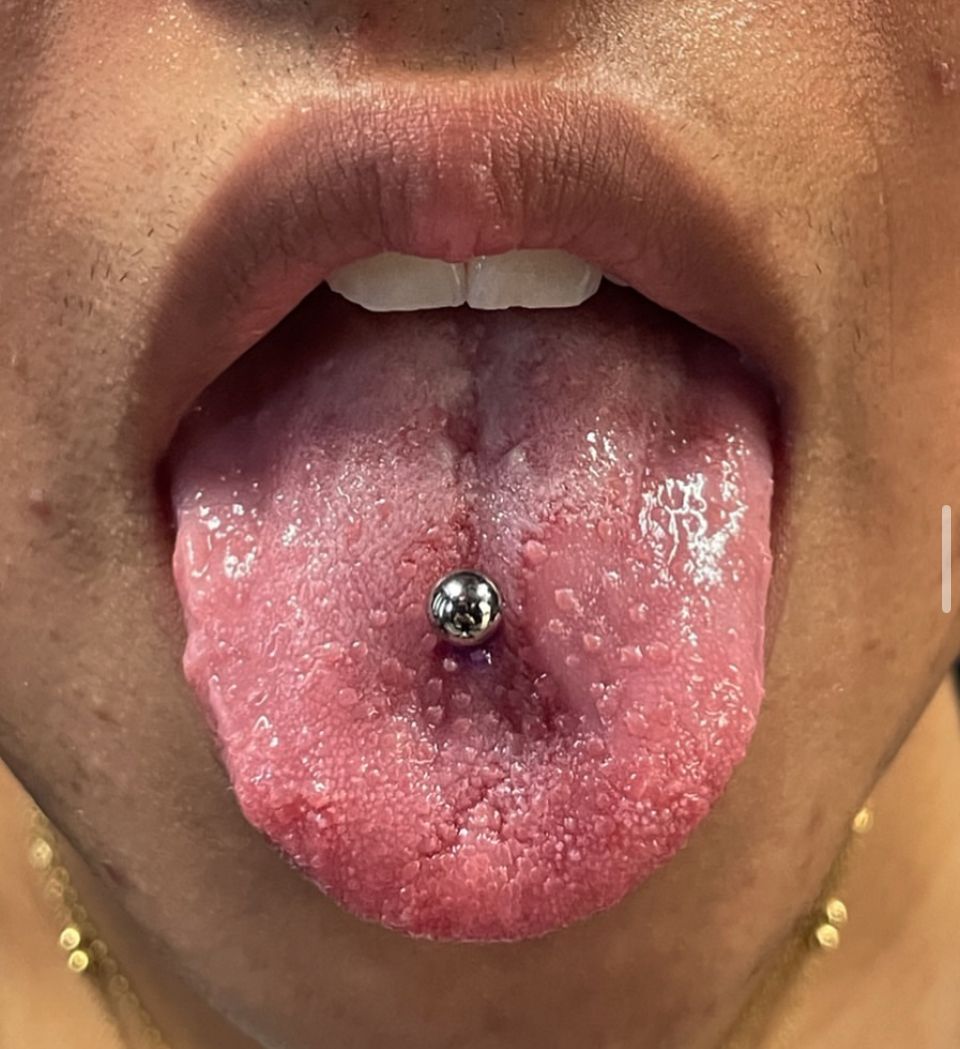A close-up of a woman's tongue with a piercing in it.