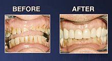 Dental procedure comparison