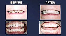 Dental surgery comparison