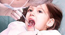 Dentist checking the teeth of the kid