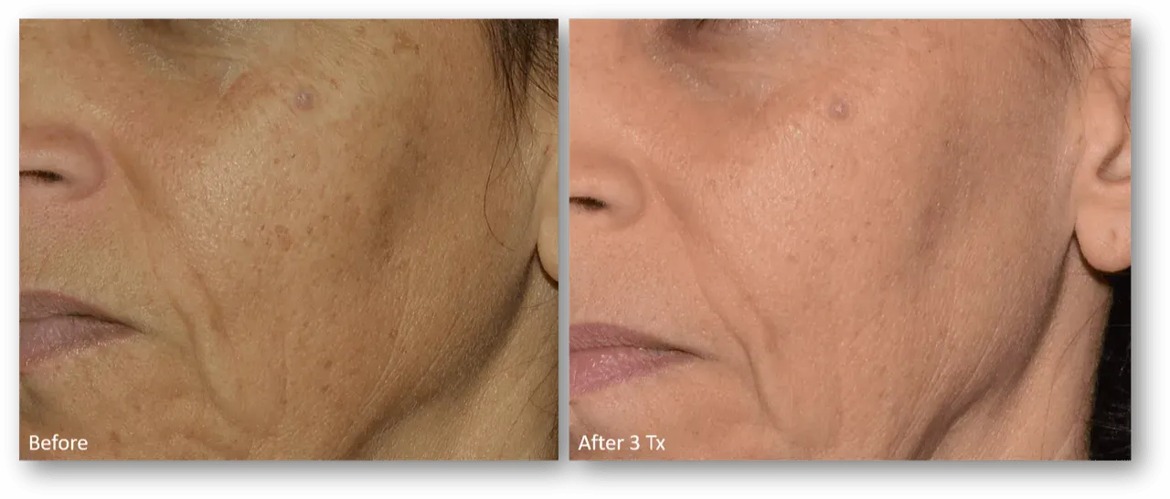 bella medspa-gallery-030