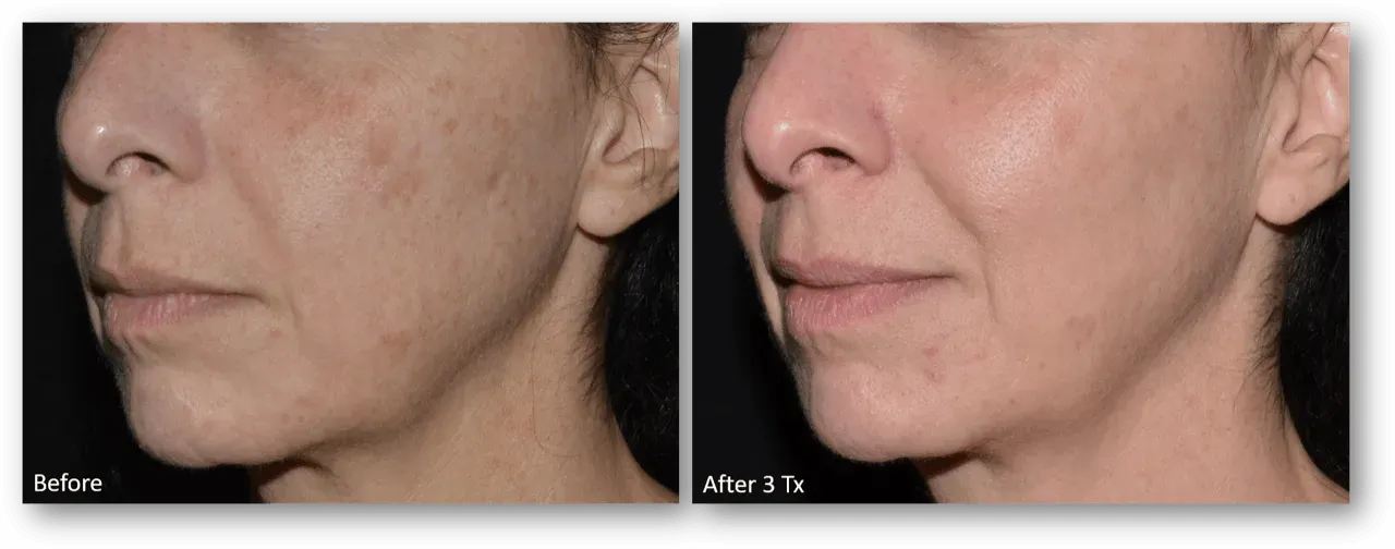 bella medspa-gallery-026