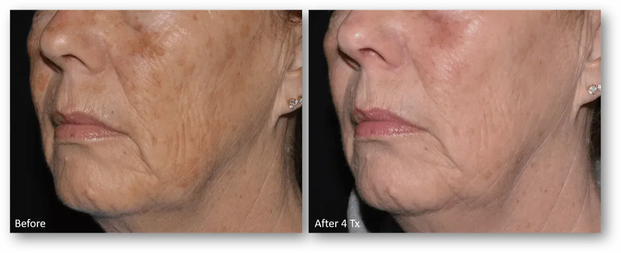 bella medspa-gallery-025