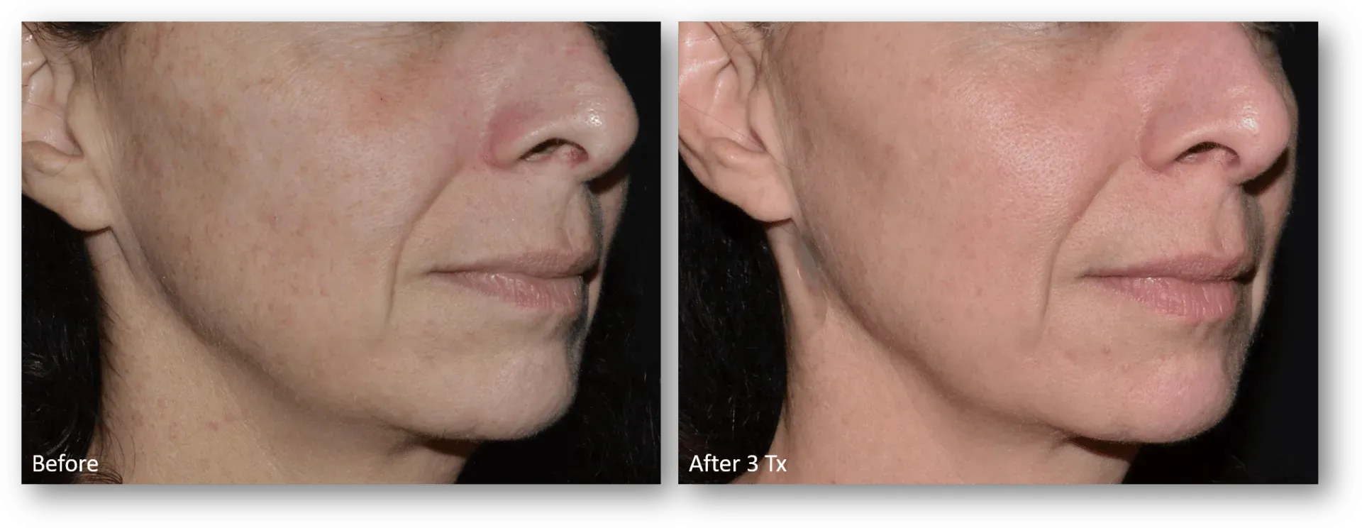 bella medspa-gallery-027