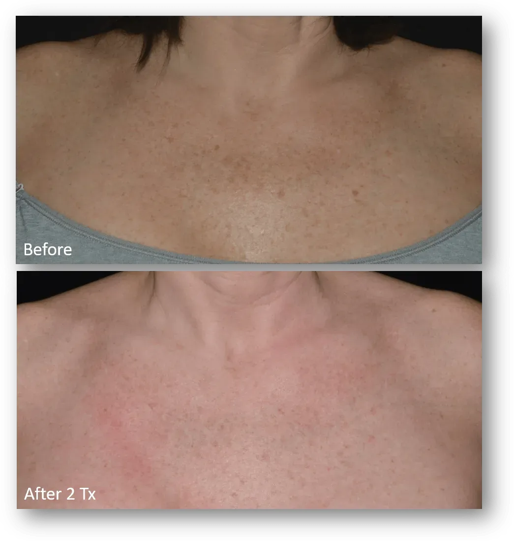 bella medspa-gallery-032