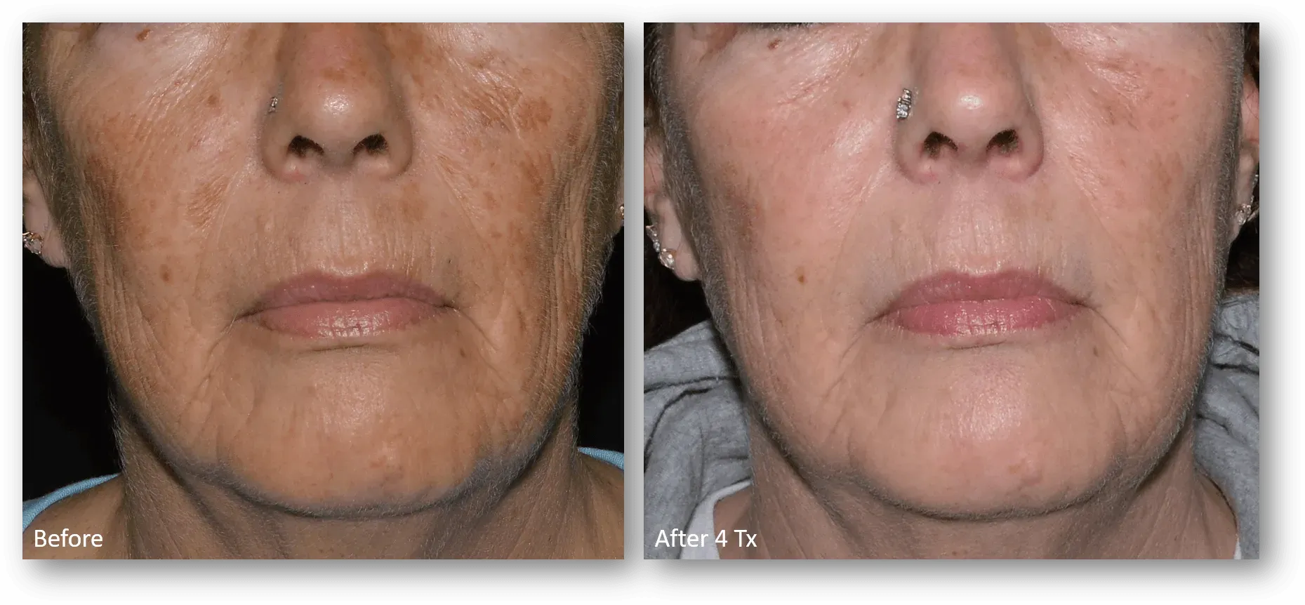 bella medspa-gallery-029