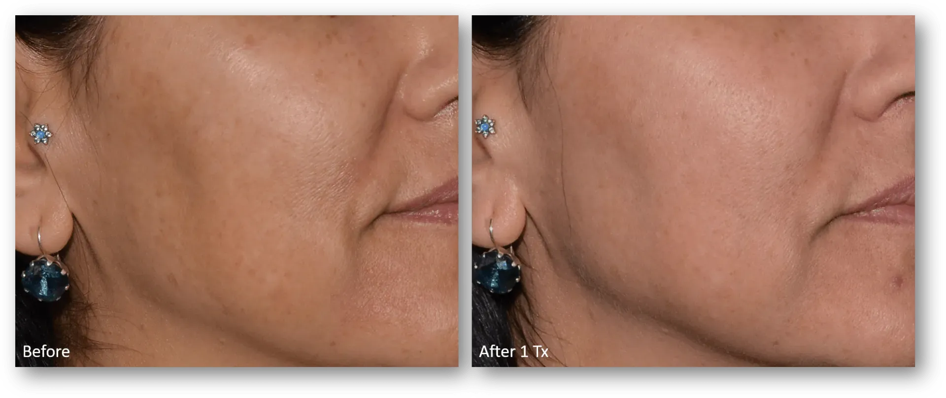 bella medspa-gallery-028