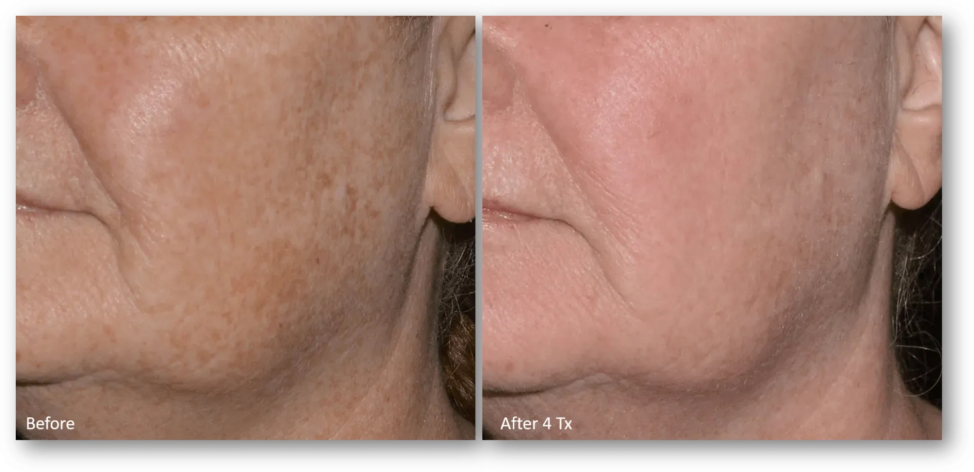 bella medspa-gallery-024