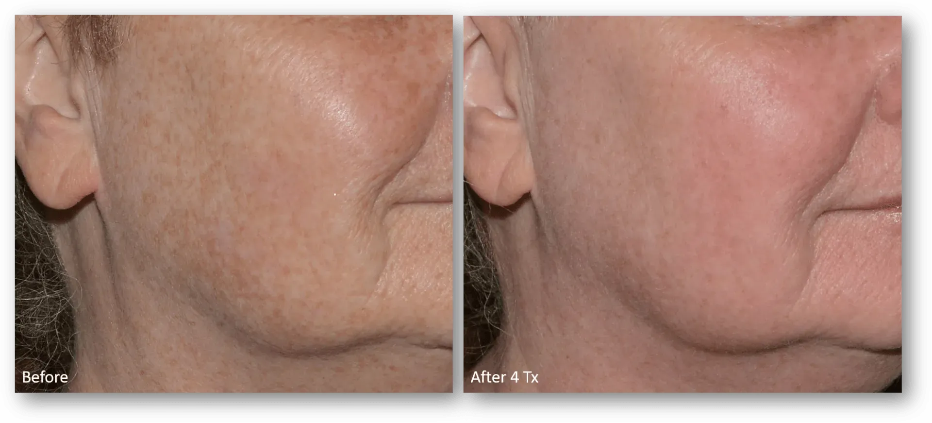 bella medspa-gallery-023