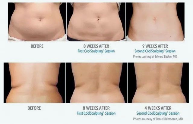 bella medspa-gallery-039