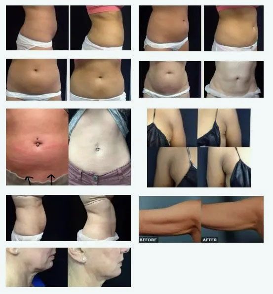 bella medspa-gallery-040