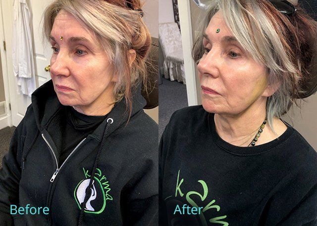 bella medspa-gallery-019