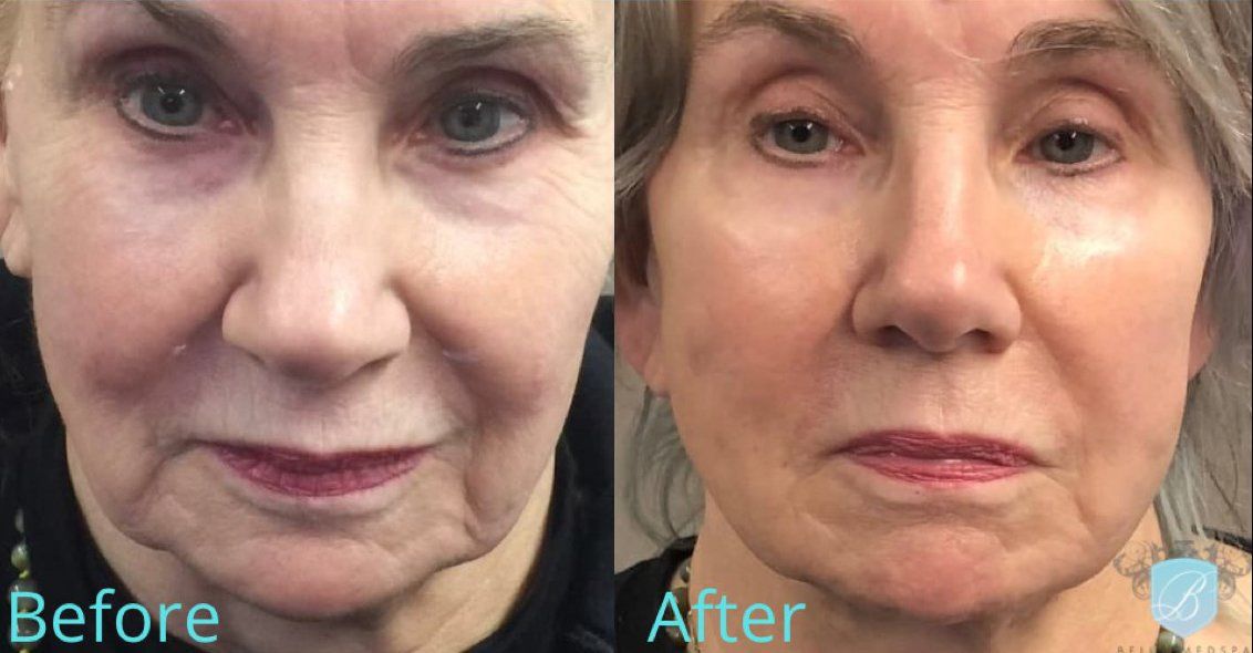 bella medspa-gallery-020