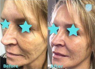 bella medspa-gallery-021