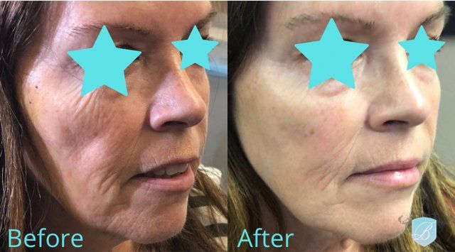 bella medspa-gallery-022