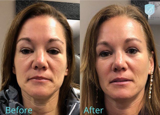 bella medspa-gallery-023