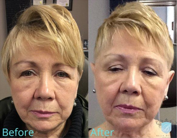 bella medspa-gallery-024