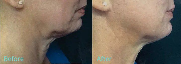 bella medspa-gallery-025