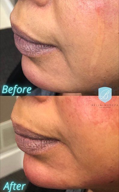 bella medspa-gallery-013