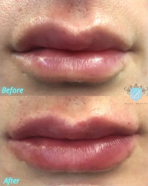 bella medspa-gallery-011