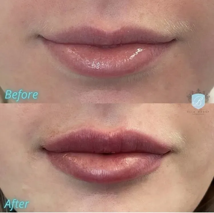 bella medspa-gallery-016