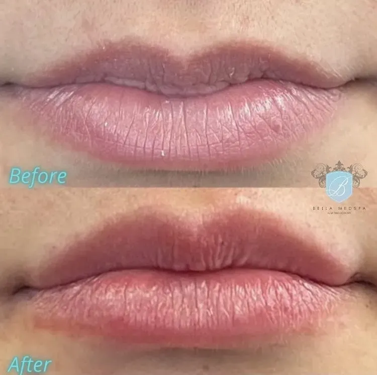 bella medspa-gallery-017