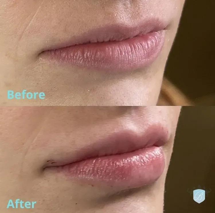 bella medspa-gallery-014