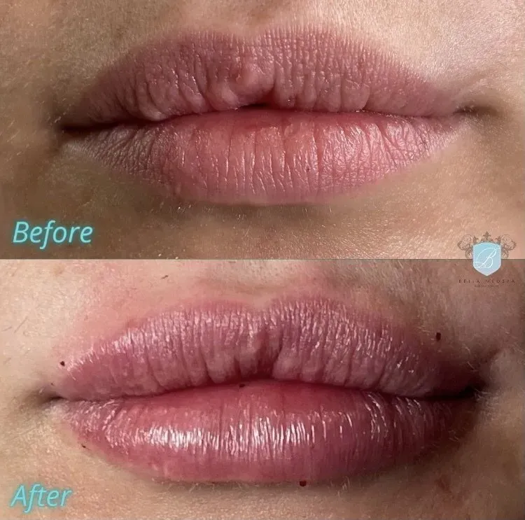 bella medspa-gallery-012