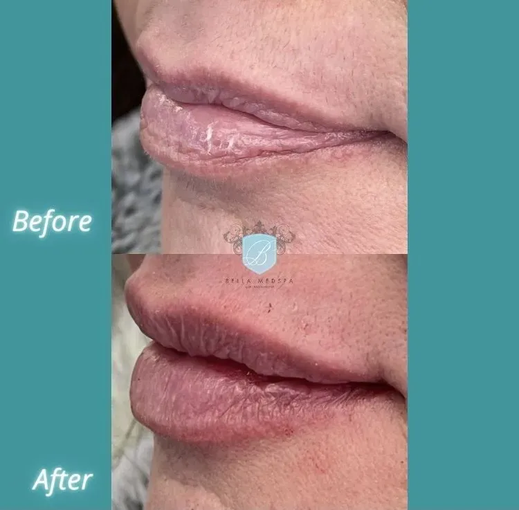 bella medspa-gallery-015