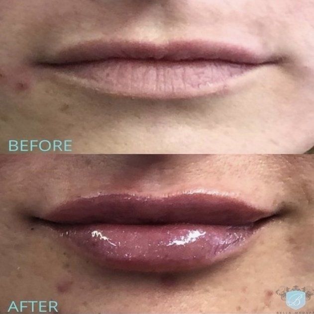 bella medspa-gallery-010