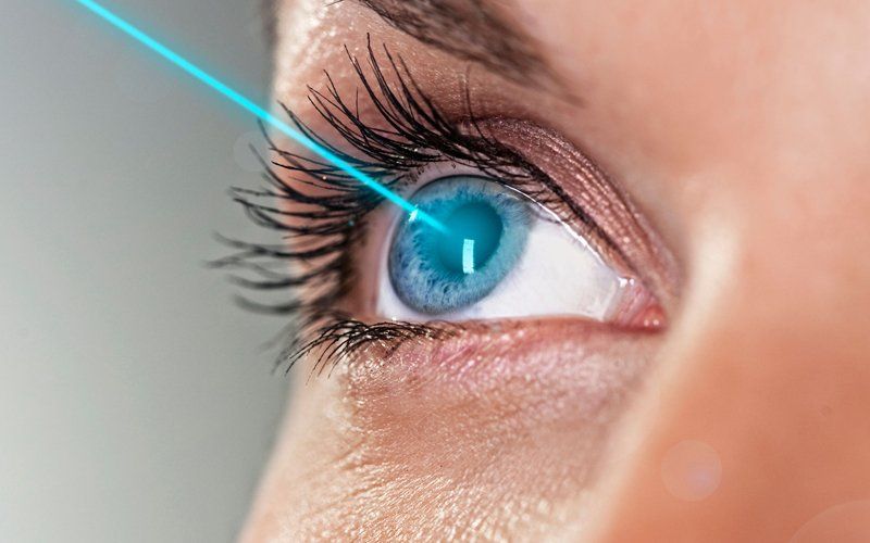 Lasik eye surgery