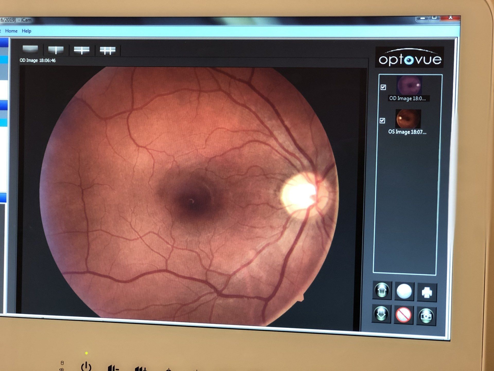 Eyeglasses Dyersburg, TN