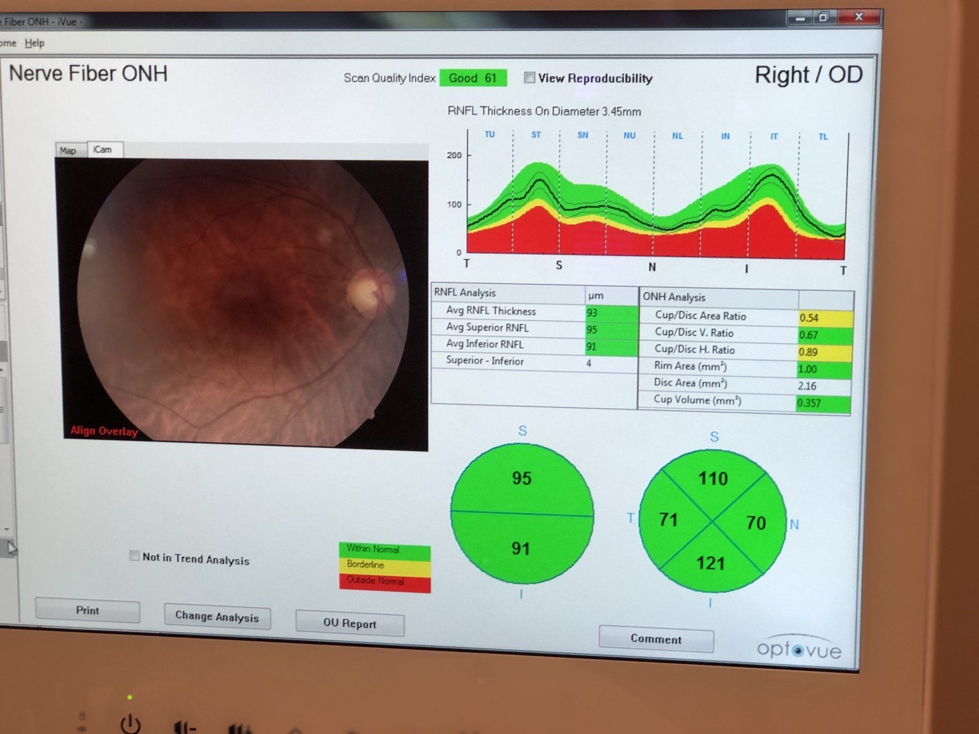 Eyeglasses Dyersburg, TN