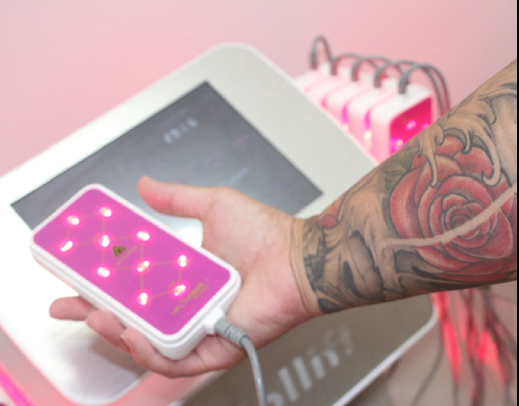 Lips Supporting Image