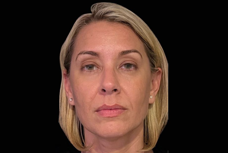 a close up of a person