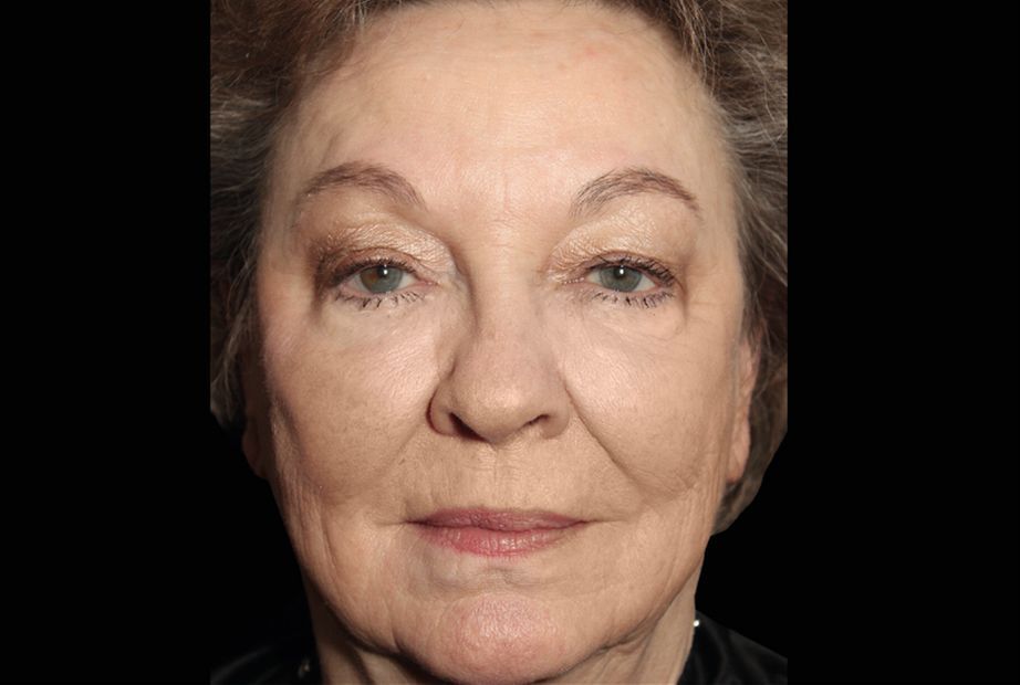 a close up of a elderly person's face