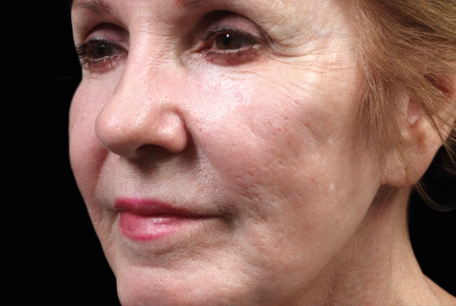 a close up of a women's face