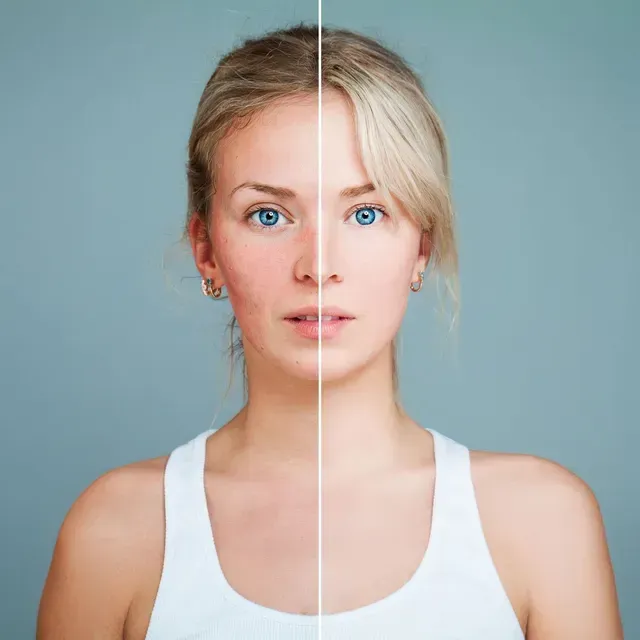 A before and after photo of a woman 's face.