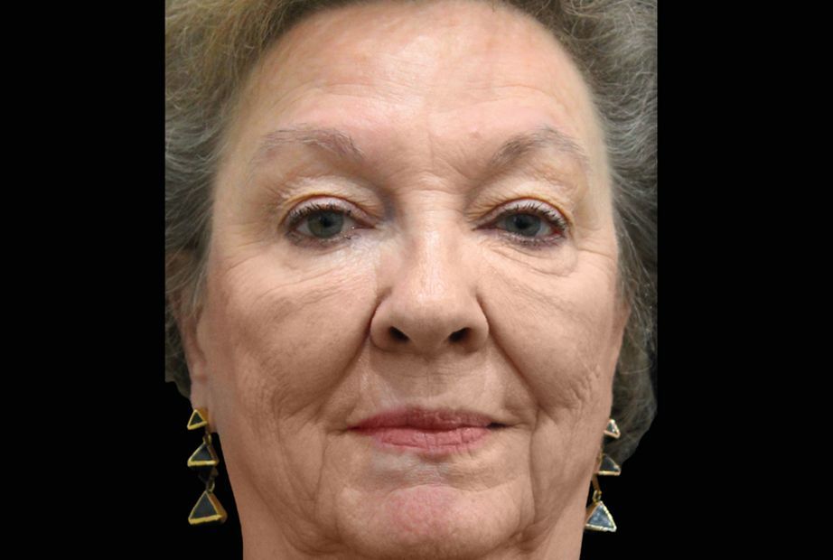 a close up of a elderly women's face