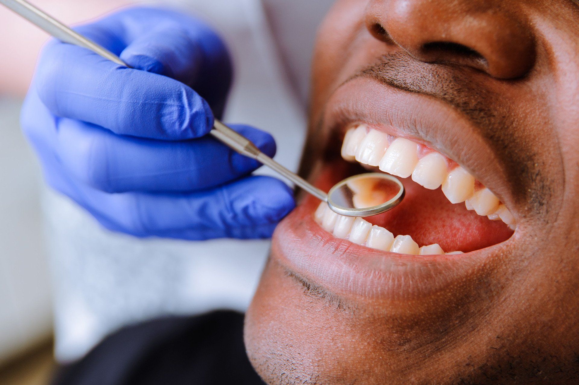 Dentist examining a patient’s teeth with a mouth mirror and blue gloves