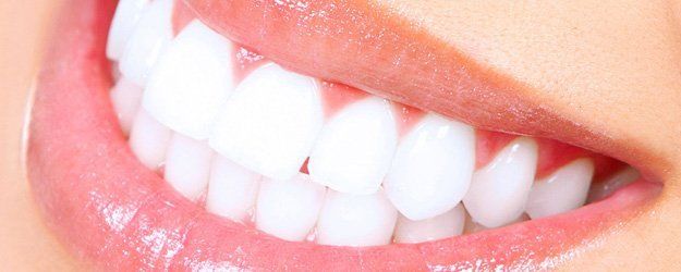 porcelain white teeth
